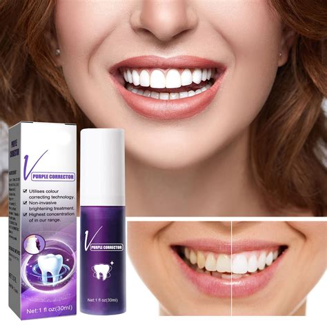 teeth whitening sales reps
